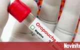 Франция съобщи за първи случай на вируса Шамонда при човек, пациентът е починал